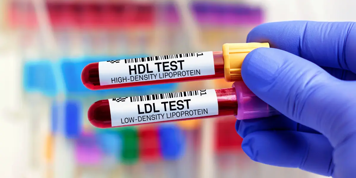 doplnky stravy na zníženie cholesterolu – LDL